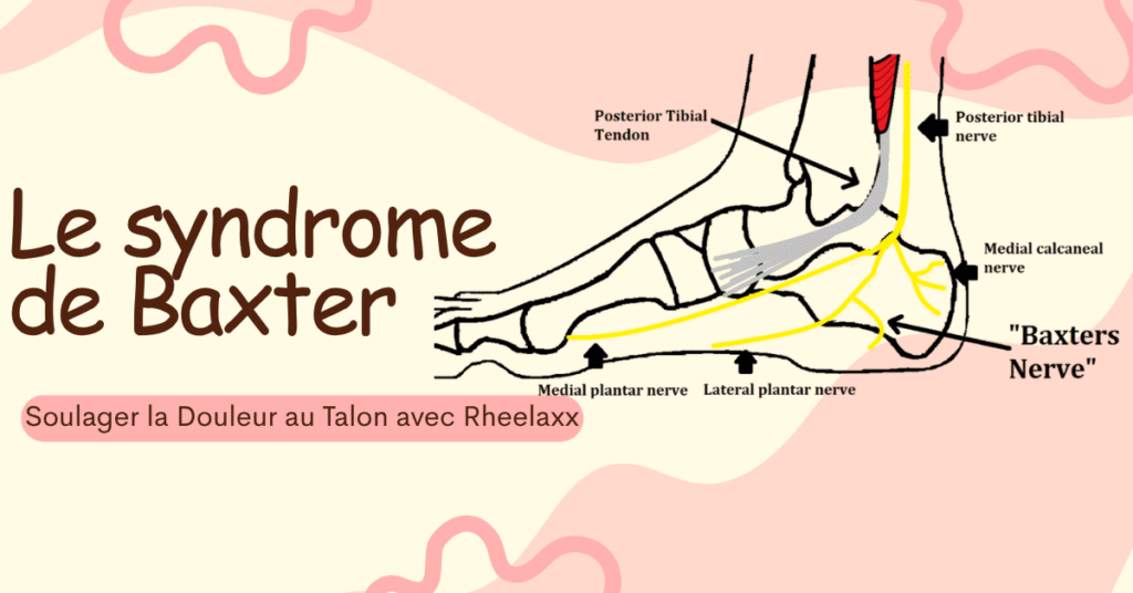 Le syndrome de Baxter