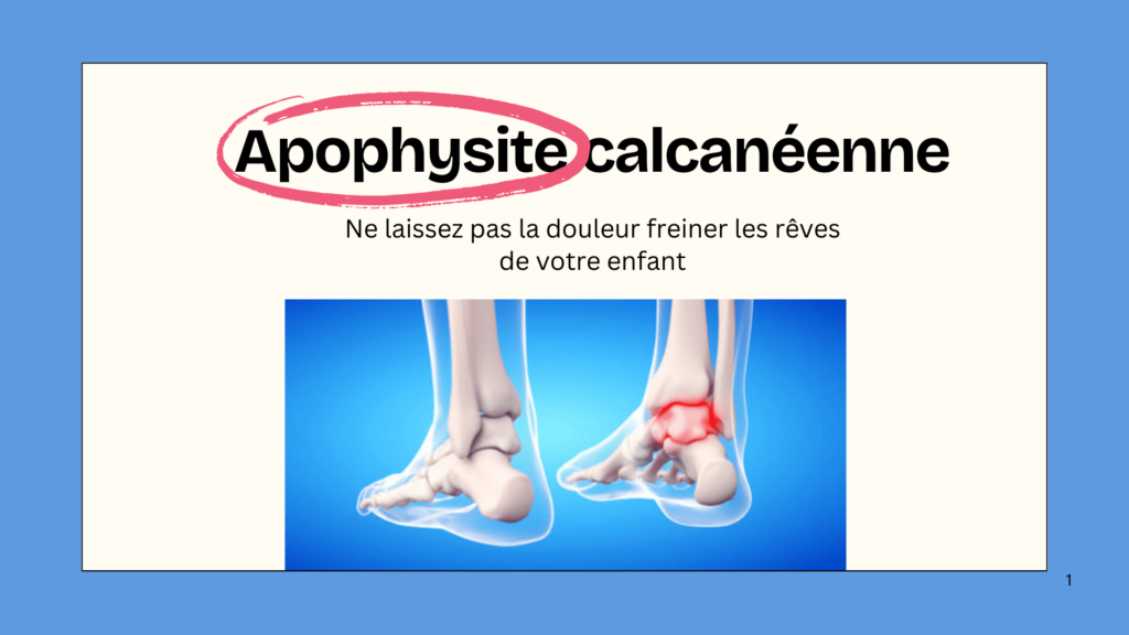 Apophysite calcanéenne Ne laissez pas la douleur freiner les rêves de votre enfant